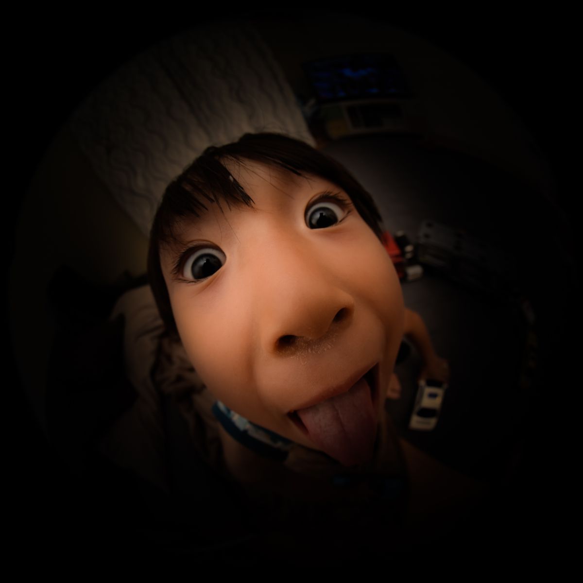 驚きの顔 症例post ✎𓈒𓂂𓏸 👩🏻‍⚕️田宮エリーDr. @dr.erry_emma